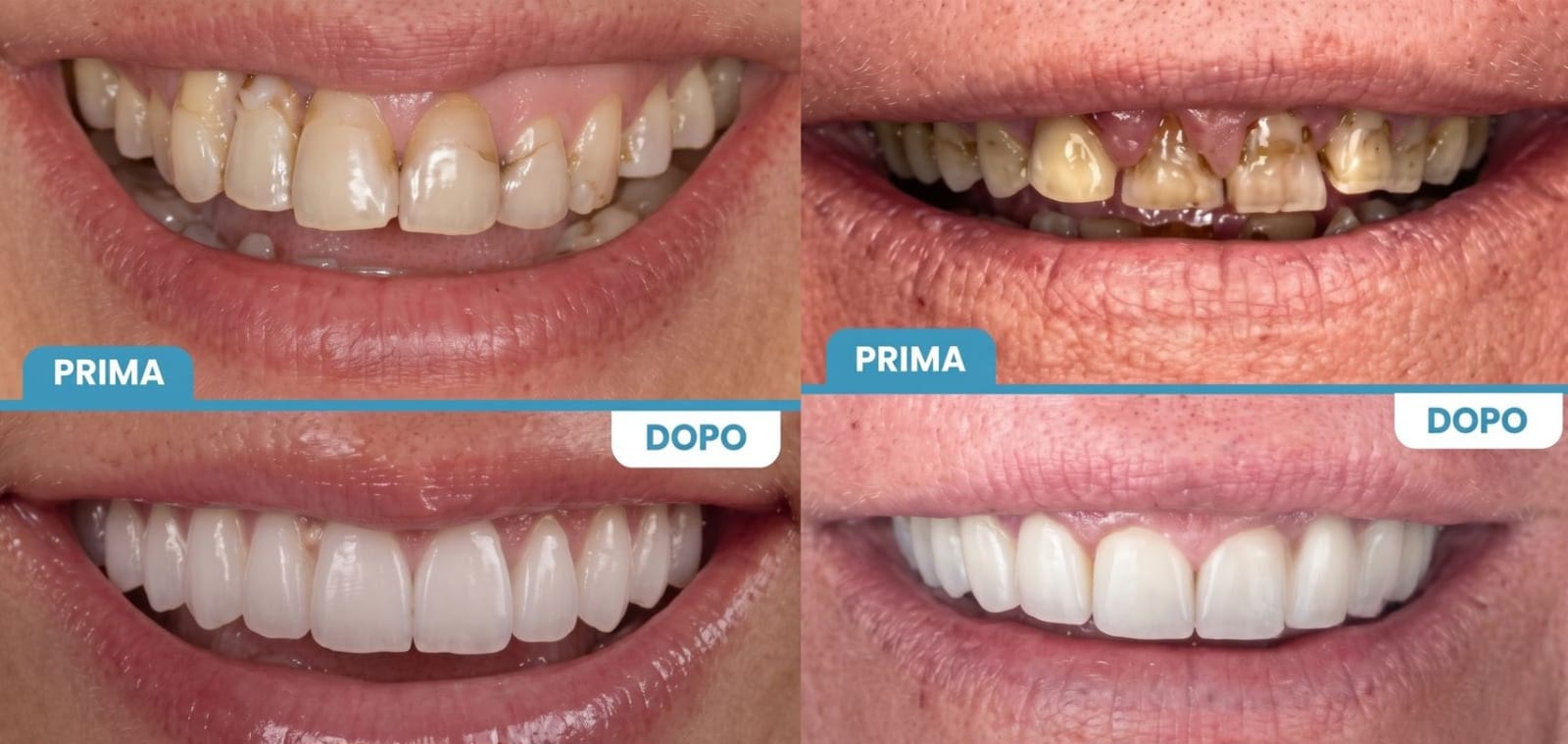 Tratamientos Premium en Dental Élite